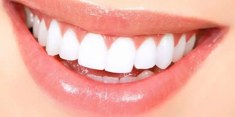 दातांची निगा कशी राखावी? दातांसाठी कोणती टूथपेस्ट चांगली? दातांची निगा