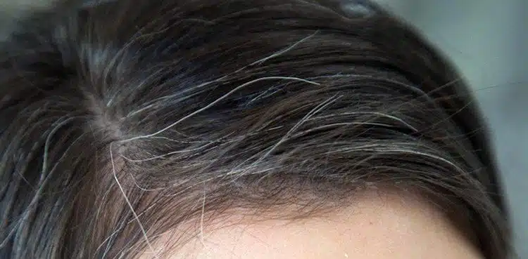 पांढऱ्या केसांवर काही घरगुती उपाय  पांढऱ्या केसांवर