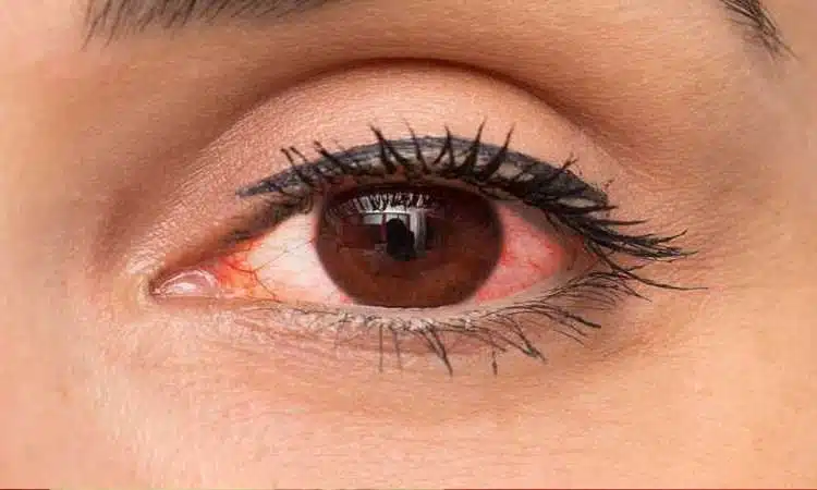 'हे' घरगुती उपायांमुळे डोळ्यांचे आजार होतात दूर, जाणून घ्या शांत