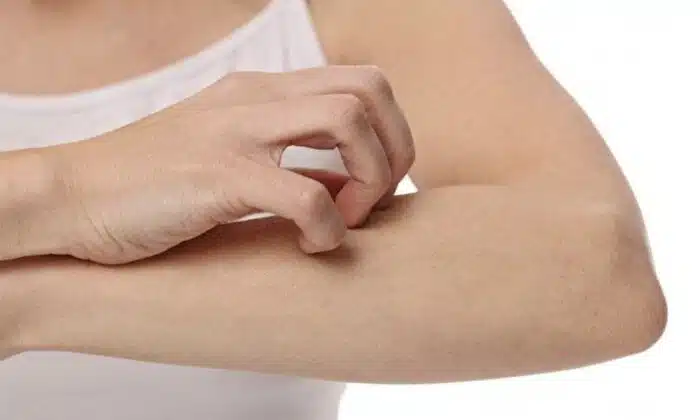 Dry Skin | हिवाळ्यामध्ये 'या' सवयी ठेवतील त्वचेला कोरडीपणापासून दूर Skin Care Tips